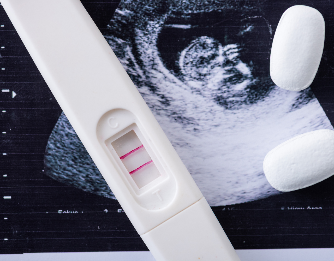Aborto.